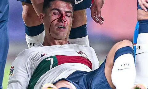 CR7 đổ máu trong chiến thắng của Bồ Đào Nha trước CH Czech
