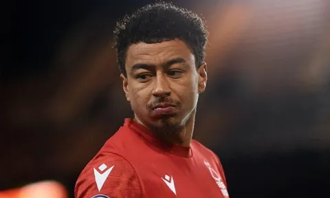 Jesse Lingard chỉ trích Man United