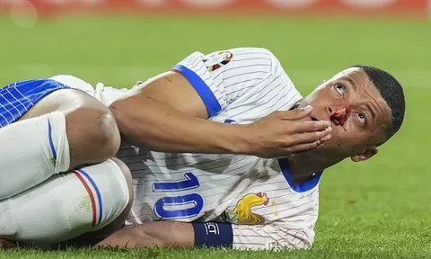 Kylian Mbappe vỡ mũi và phải phẫu thuật khẩn cấp