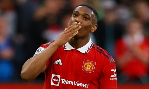 Man United thiệt quân trước trận chung kết FA Cup