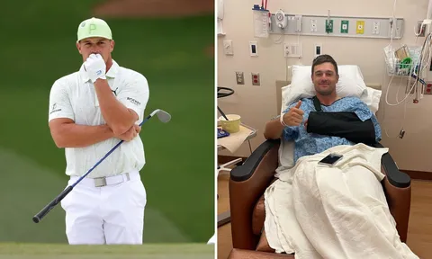 DeChambeau phẫu thuật tay trái thành công
