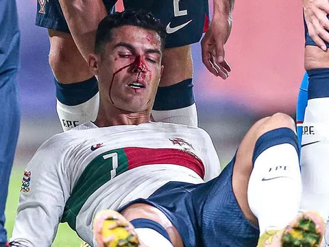 CR7 đổ máu trong chiến thắng của Bồ Đào Nha trước CH Czech