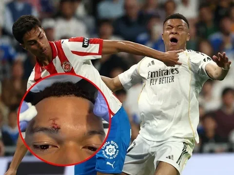 Kylian Mbappe khiến các fan hâm mộ Real Madrid lo lắng